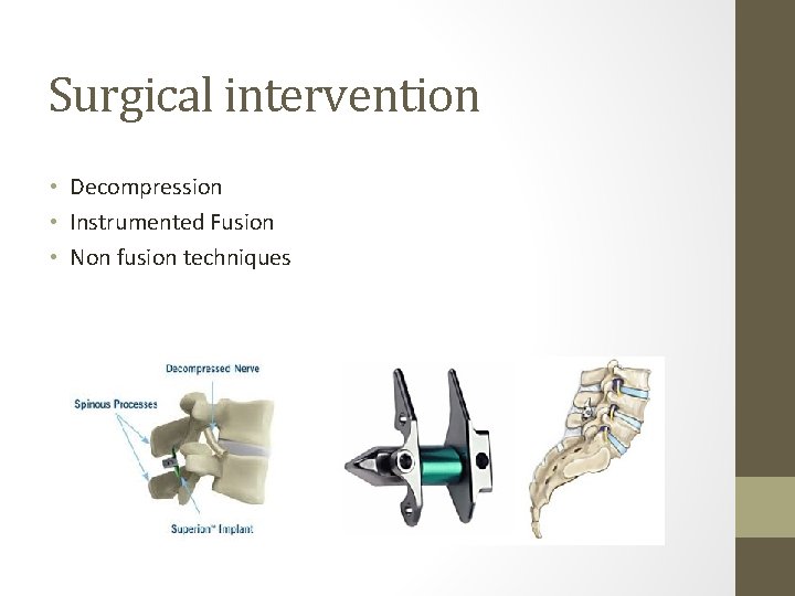 Surgical intervention • Decompression • Instrumented Fusion • Non fusion techniques 