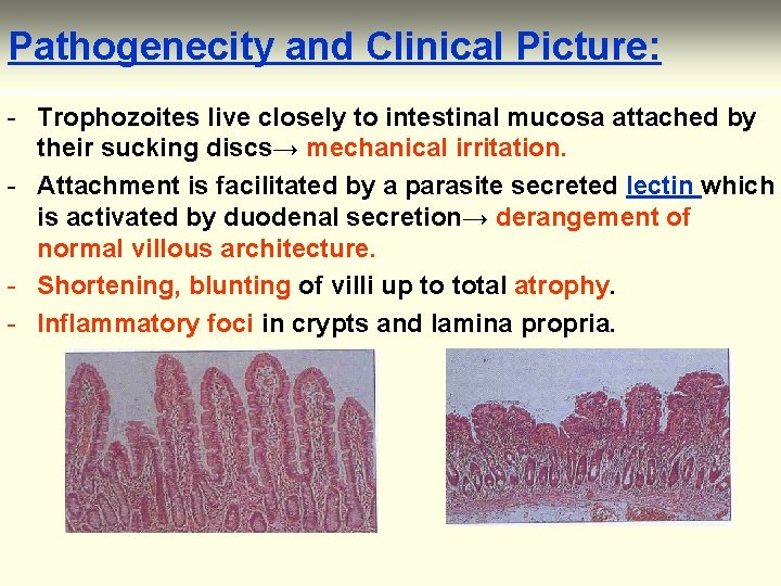 Pathogenecity and Clinical Picture: - Trophozoites live closely to intestinal mucosa attached by their
