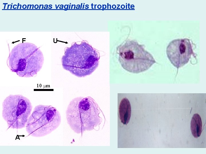 Trichomonas vaginalis trophozoite F U 10 mm A 