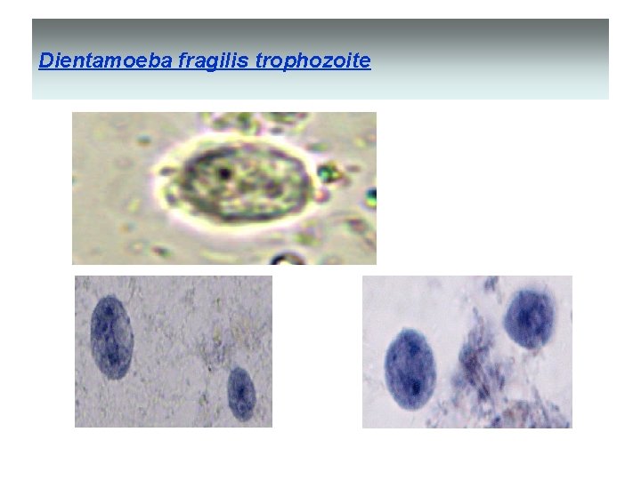 Dientamoeba fragilis trophozoite 