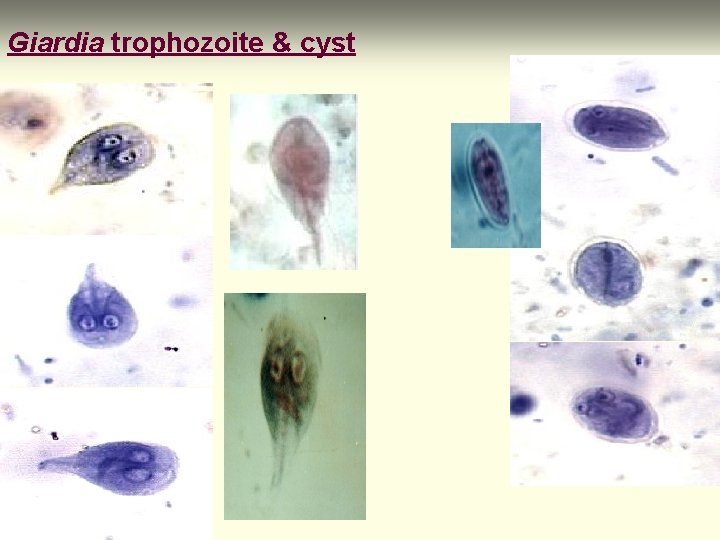 Giardia trophozoite & cyst 
