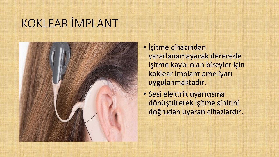 KOKLEAR İMPLANT • İşitme cihazından yararlanamayacak derecede işitme kaybı olan bireyler için koklear implant