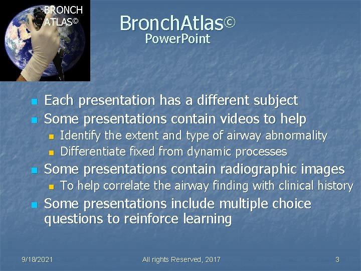 BRONCH ATLAS© Bronch. Atlas© Power. Point n n Each presentation has a different subject