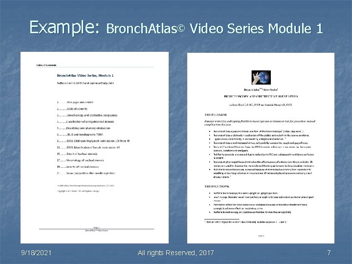 Example: Bronch. Atlas© Video Series Module 1 9/18/2021 All rights Reserved, 2017 7 