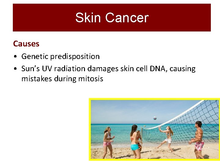 Skin Cancer Causes • Genetic predisposition • Sun’s UV radiation damages skin cell DNA,