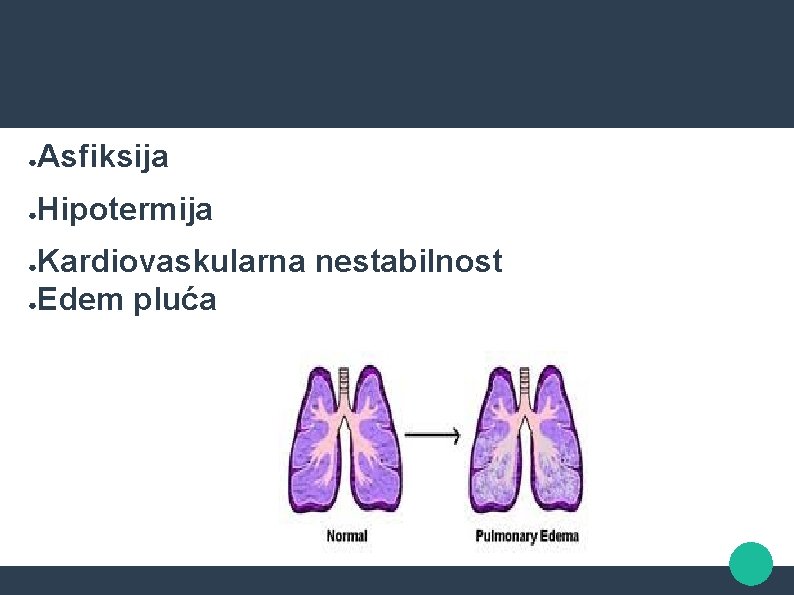 ● Asfiksija ● Hipotermija Kardiovaskularna nestabilnost ●Edem pluća ● 