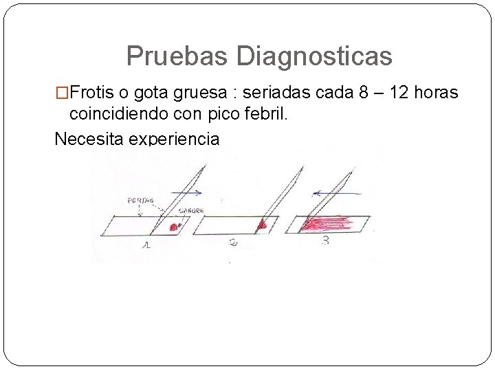 Pruebas Diagnosticas �Frotis o gota gruesa : seriadas cada 8 – 12 horas coincidiendo