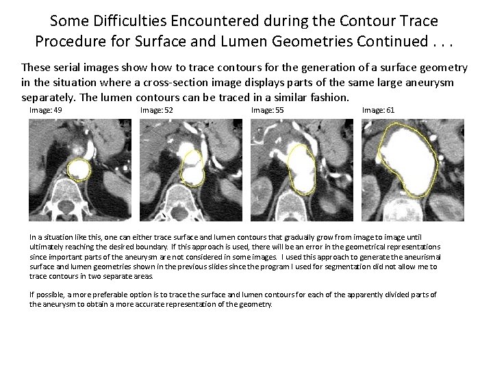 Some Difficulties Encountered during the Contour Trace Procedure for Surface and Lumen Geometries Continued.