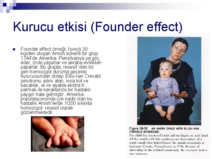 Kurucu etkisi (Founder effect) n Founder effect örneği: İsveçli 30 kişiden oluşan Amish kökenli