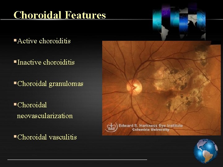 Choroidal Features §Active choroiditis §Inactive choroiditis §Choroidal granulomas §Choroidal neovascularization §Choroidal vasculitis 