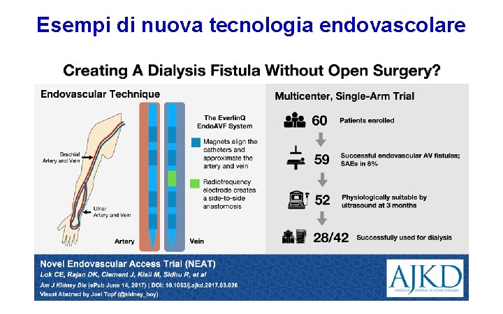 Esempi di nuova tecnologia endovascolare 