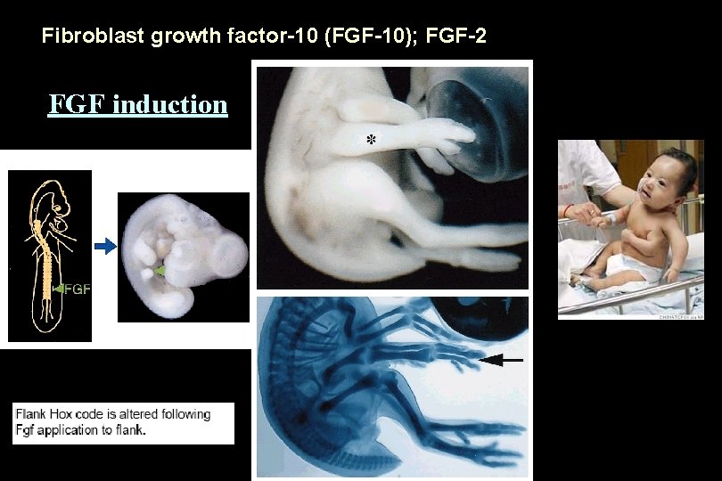 Fibroblast growth factor-10 (FGF-10); FGF-2 FGF induction 