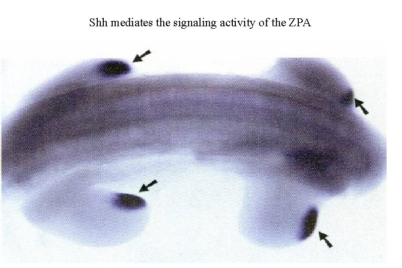 Shh mediates the signaling activity of the ZPA 