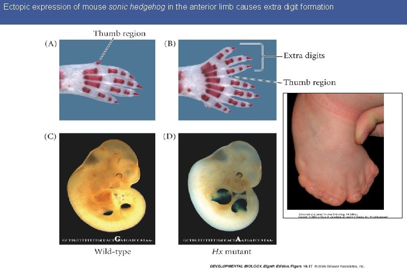 Ectopic expression of mouse sonic hedgehog in the anterior limb causes extra digit formation