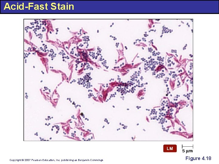 Acid-Fast Stain Copyright © 2007 Pearson Education, Inc. publishing as Benjamin Cummings Figure 4.
