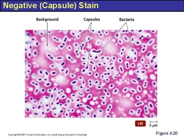 Negative (Capsule) Stain Copyright © 2007 Pearson Education, Inc. publishing as Benjamin Cummings Figure