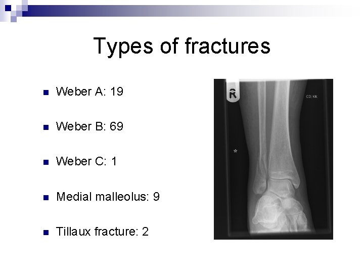 Types of fractures n Weber A: 19 n Weber B: 69 n Weber C: