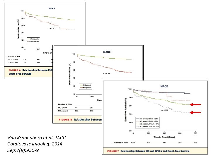 Van Kranenberg et al. JACC Cardiovasc Imaging. 2014 Sep; 7(9): 930 -9 