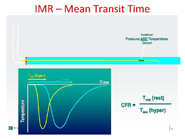 IMR – Mean Transit Time 