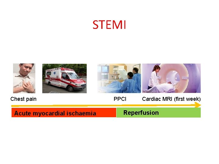 STEMI Chest pain Acute myocardial ischaemia PPCI Cardiac MRI (first week) Reperfusion 