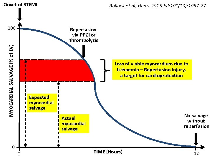 Onset of STEMI 100 Bulluck et al, Heart 2015 Jul; 101(13): 1067 -77 MYOCARDIAL