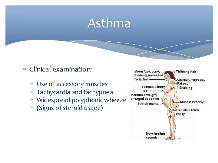 Asthma Clinical examination: Use of accessory muscles Tachycardia and tachypnea Widespread polyphonic wheeze (Signs