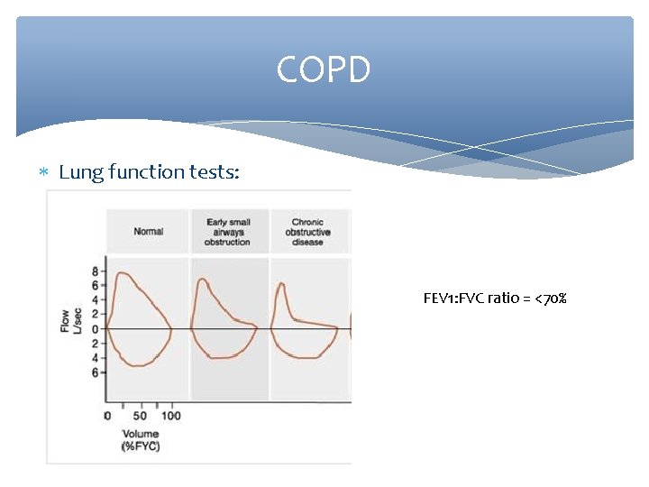 COPD Lung function tests: FEV 1: FVC ratio = <70% 