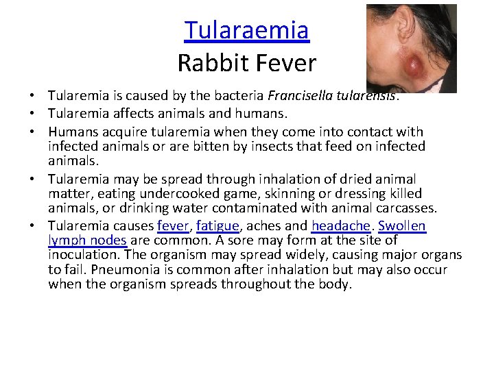 Tularaemia Rabbit Fever • Tularemia is caused by the bacteria Francisella tularensis. • Tularemia