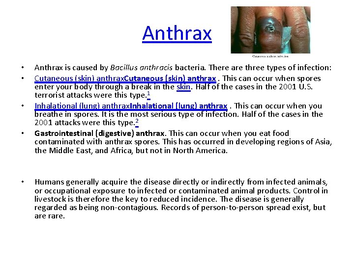 Anthrax • • • Anthrax is caused by Bacillus anthracis bacteria. There are three