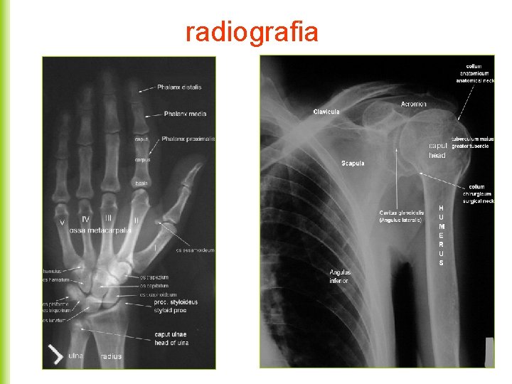 radiografia 