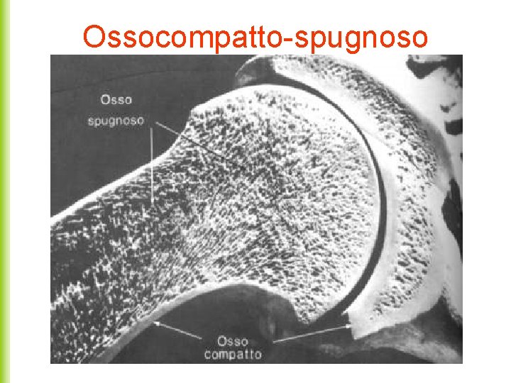 Ossocompatto-spugnoso 