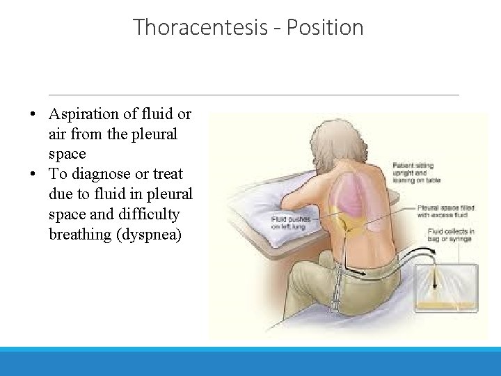 Thoracentesis - Position • Aspiration of fluid or air from the pleural space •