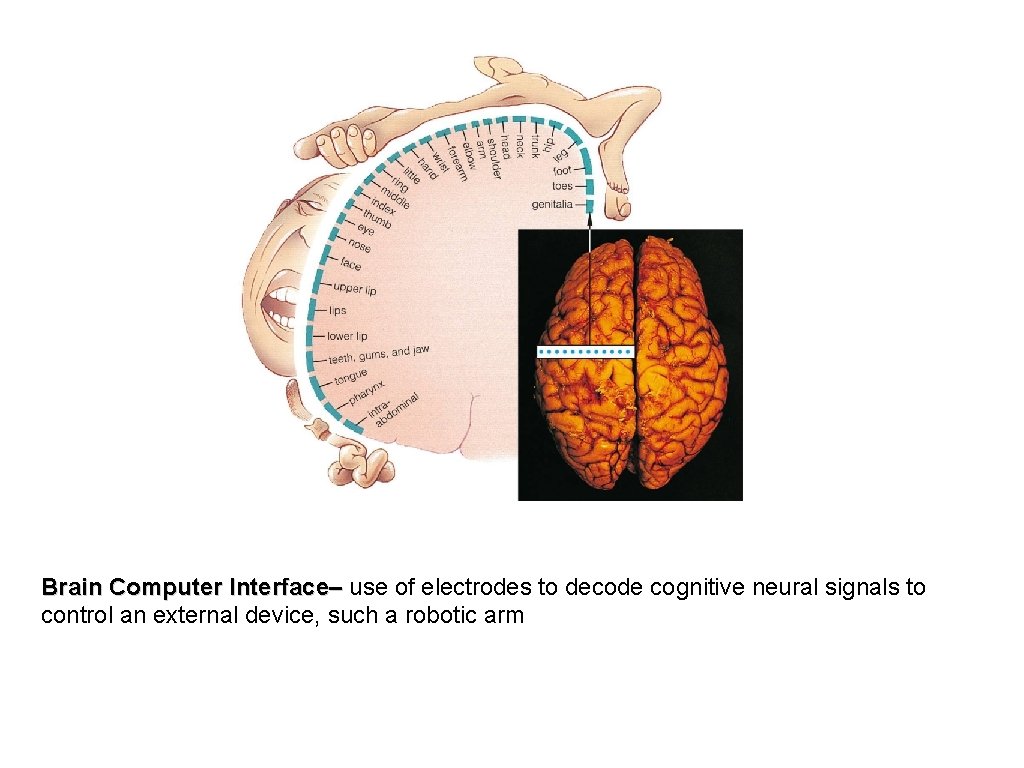 Brain Computer Interface– use of electrodes to decode cognitive neural signals to control an