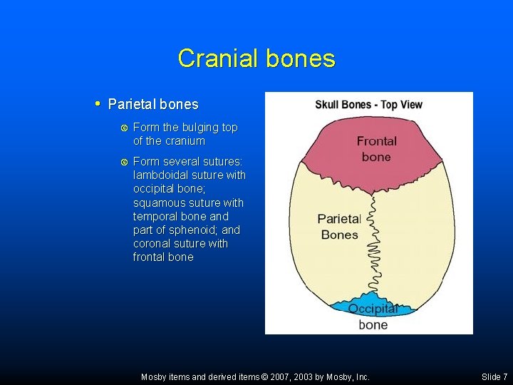 Cranial bones • Parietal bones Form the bulging top of the cranium Form several