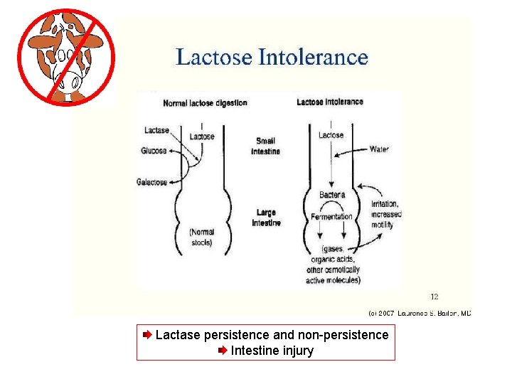Lactase persistence and non-persistence Intestine injury 
