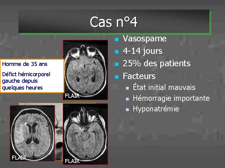 Cas n° 4 n n Homme de 35 ans n Défict hémicorporel gauche depuis