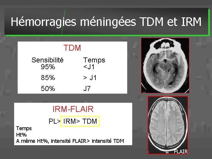 Hémorragies méningées TDM et IRM TDM Sensibilité 95% Temps <J 1 85% > J