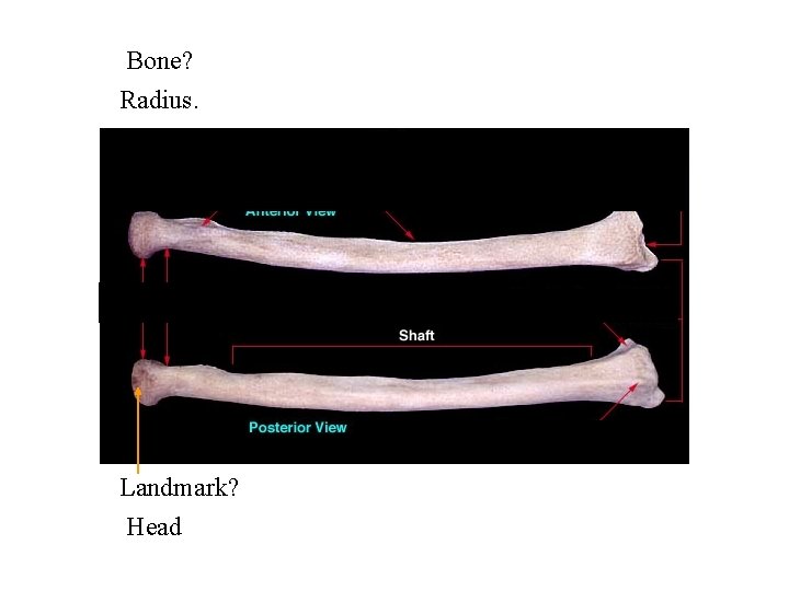 Bone? Radius. Landmark? Head 