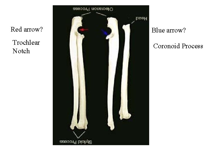 Red arrow? Trochlear Notch Blue arrow? Coronoid Process 