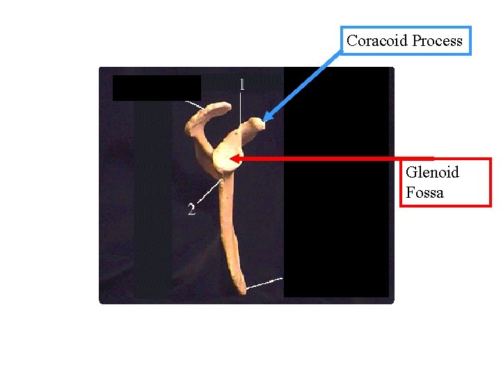 Coracoid Process Glenoid Fossa 