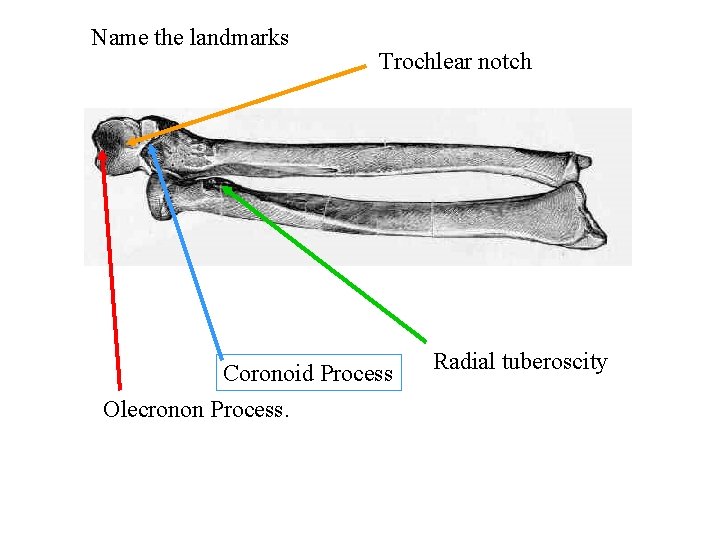 Name the landmarks Trochlear notch Coronoid Process Olecronon Process. Radial tuberoscity 