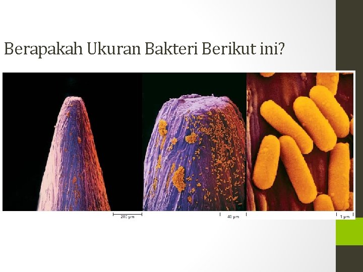 Berapakah Ukuran Bakteri Berikut ini? 