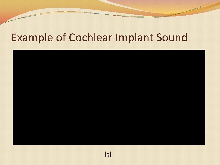 Example of Cochlear Implant Sound [5] 