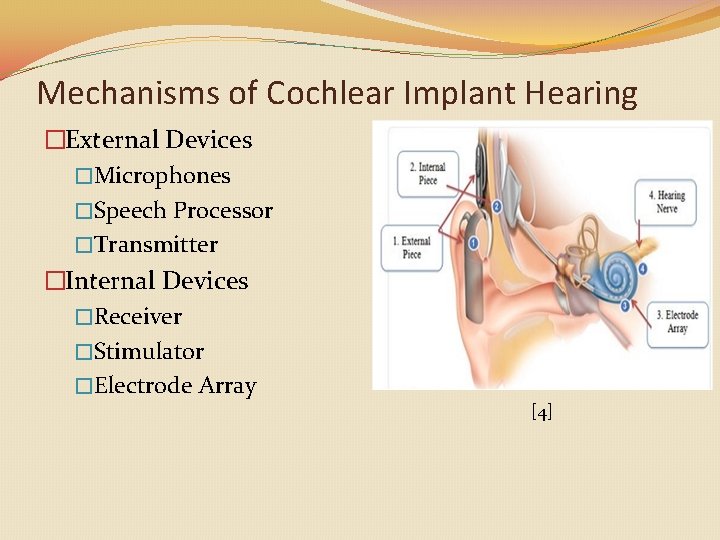 Mechanisms of Cochlear Implant Hearing �External Devices �Microphones �Speech Processor �Transmitter �Internal Devices �Receiver