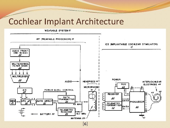 Cochlear Implant Architecture [6] 