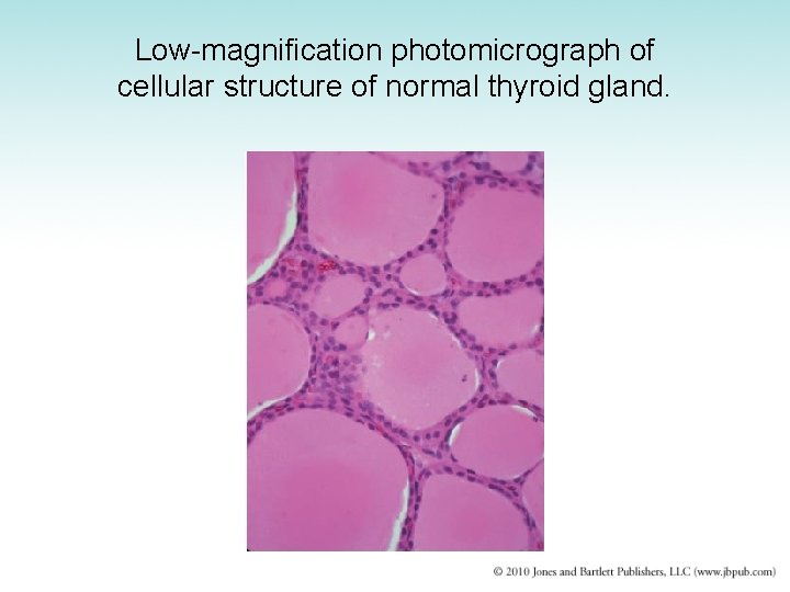 Low-magnification photomicrograph of cellular structure of normal thyroid gland. 