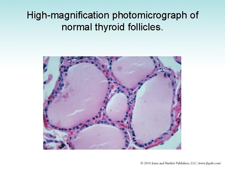 High-magnification photomicrograph of normal thyroid follicles. 