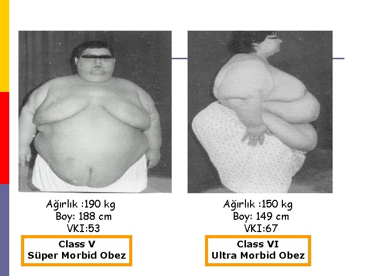 Ağırlık : 190 kg Boy: 188 cm VKI: 53 Class V Süper Morbid Obez