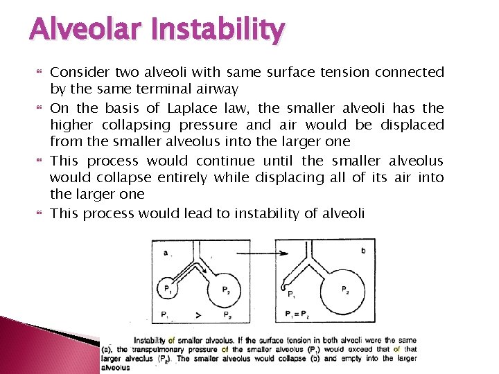 Alveolar Instability Consider two alveoli with same surface tension connected by the same terminal