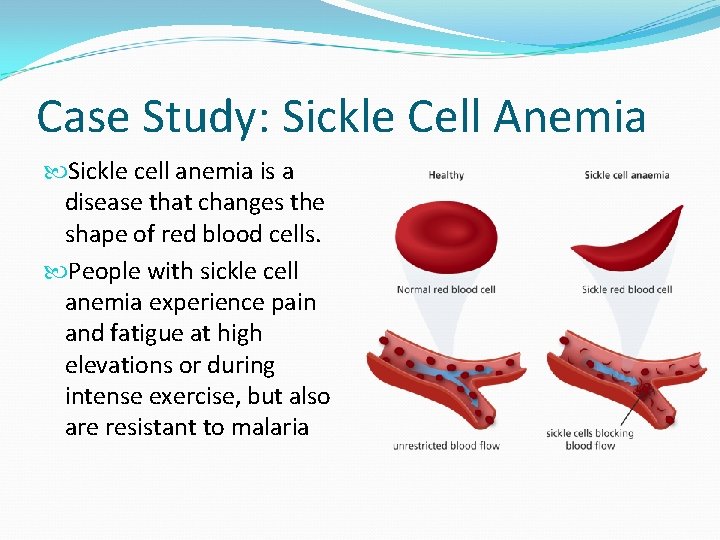 Case Study: Sickle Cell Anemia Sickle cell anemia is a disease that changes the